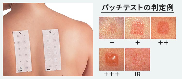 当院でできる検査画像2